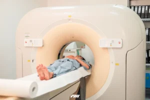 Teknologi Medis Membantu Deteksi Dini Penyakit Alzheimer dan Ebola